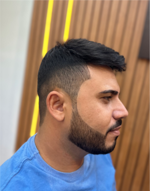 Prótese Capilar - Hercules Oliveira em Fortaleza