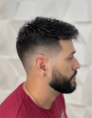 Prótese Capilar - Hercules Oliveira em Fortaleza