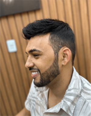 Prótese Capilar - Hercules Oliveira em Fortaleza